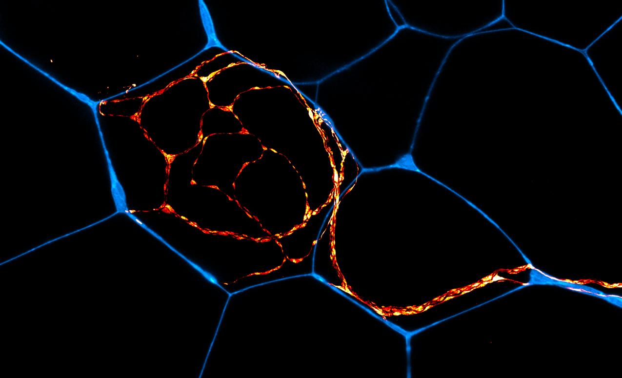 Microscope image of peripheral nerves (red/yellow) and adipocytes, or fat cells (blue)