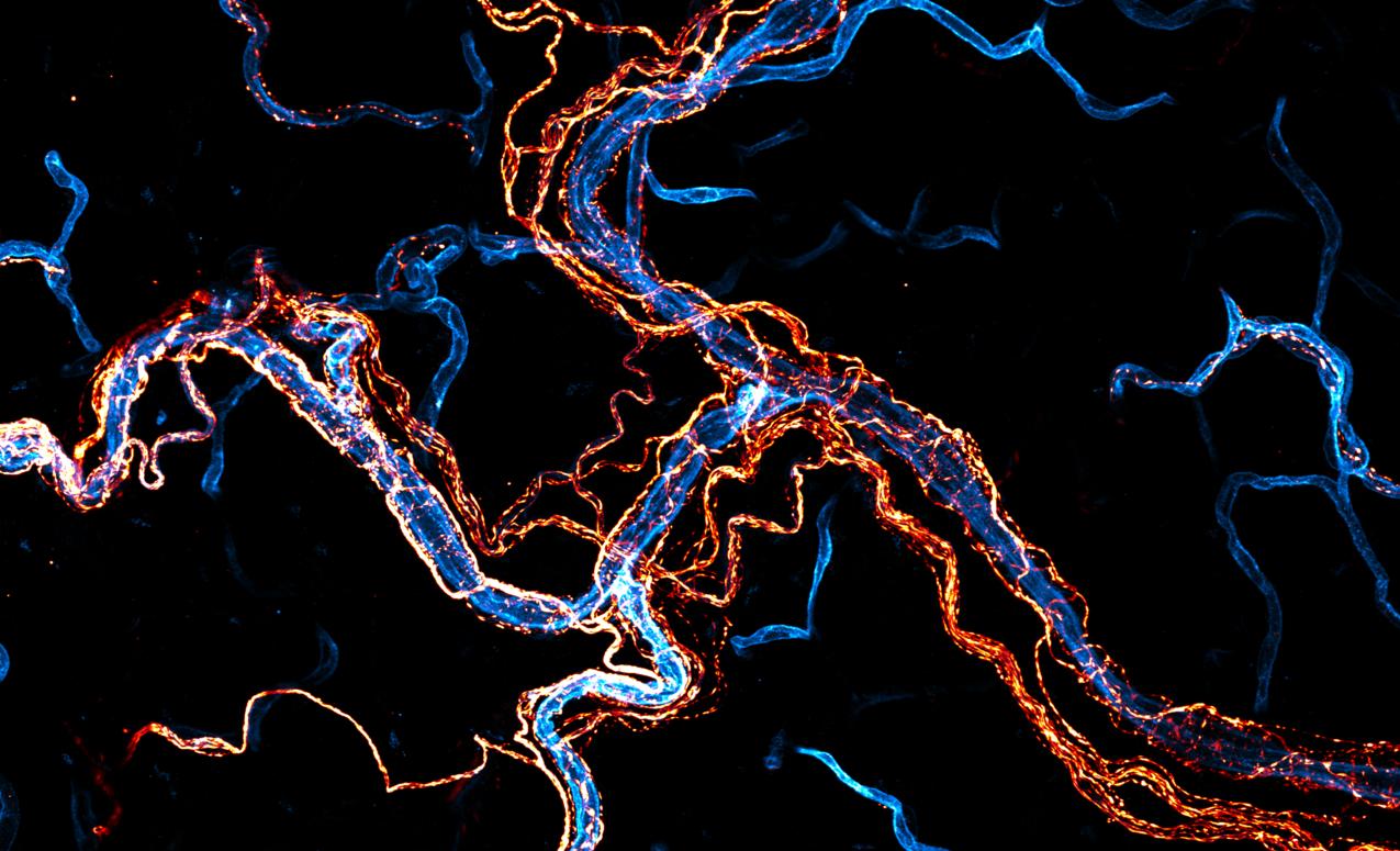 Microscope image showing innervation of the vasculature in adipose tissues