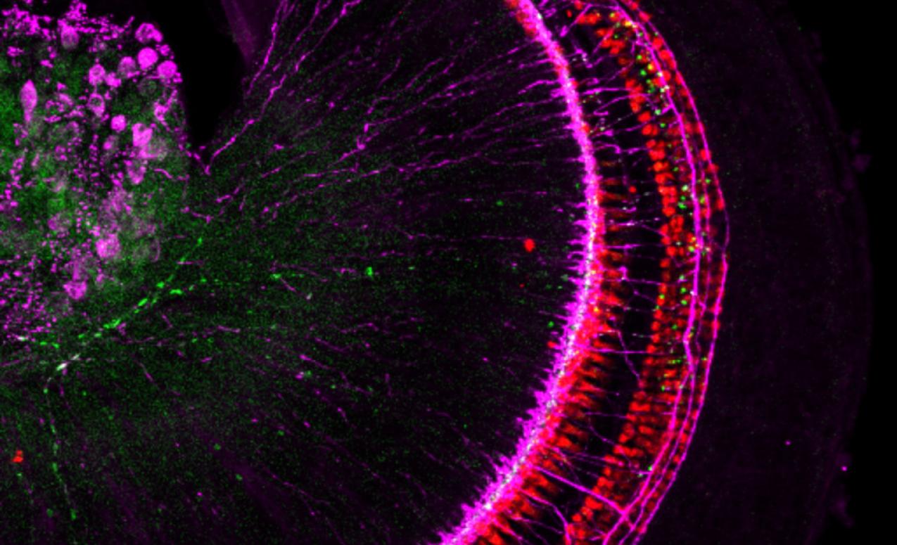 Microscope image showing gene delivery to spiral ganglion neurons