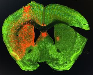 Microscope image of brain showing highlighted area