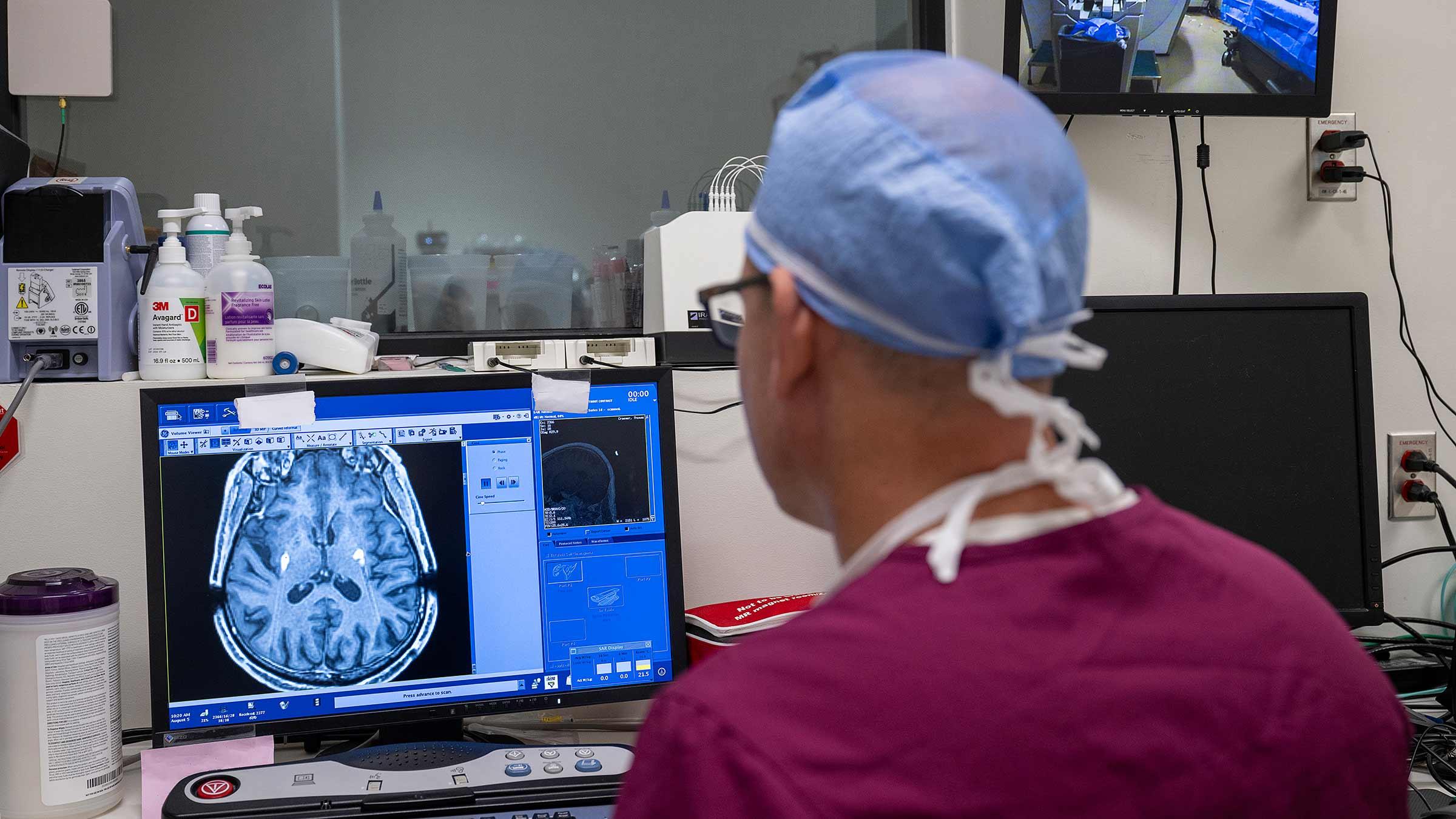 Doctor reviewing a MRI brain scan