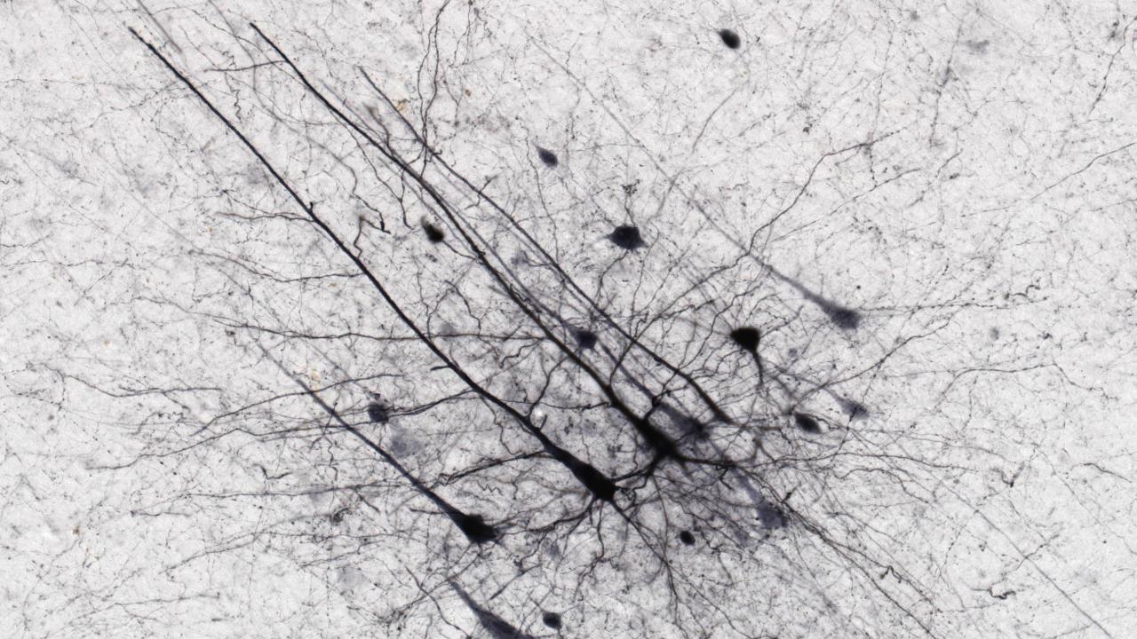 Neurons