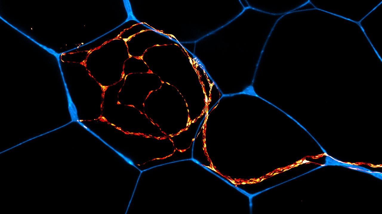 Microscope image of peripheral nerves (red/yellow) and adipocytes, or fat cells (blue)